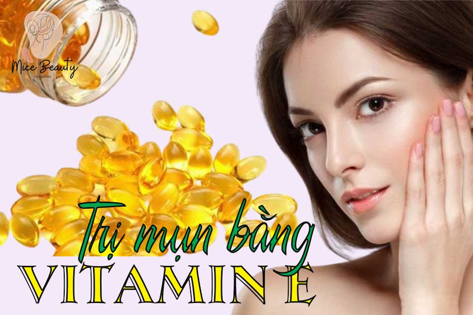 Tại sao nên sử dụng Vitamin E để trị mụn?